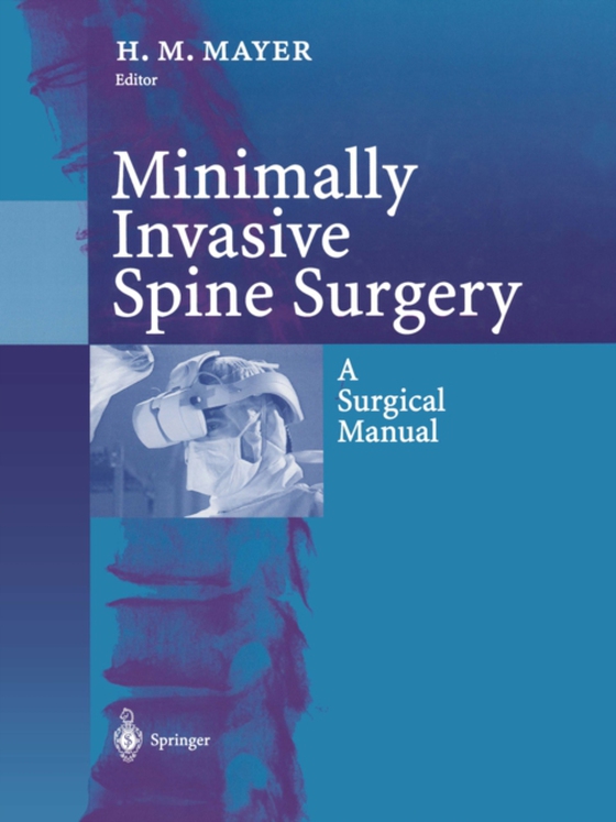 Minimally Invasive Spine Surgery