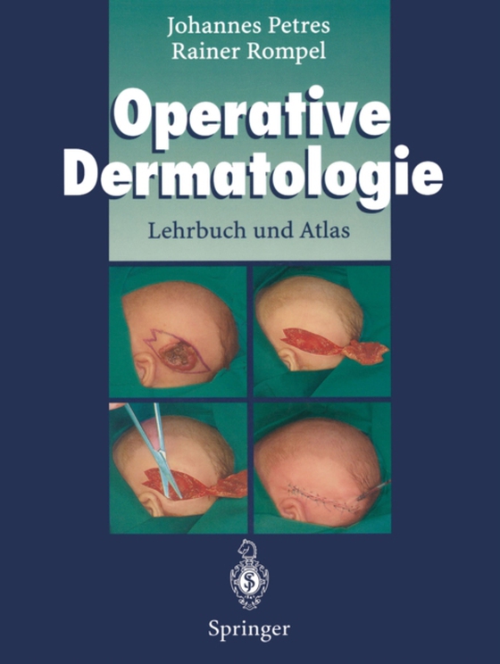 Operative Dermatologie (e-bog) af Darroll, Robert