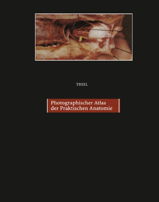 Photographischer Atlas der Praktischen Anatomie II (e-bog) af Thiel, Walter