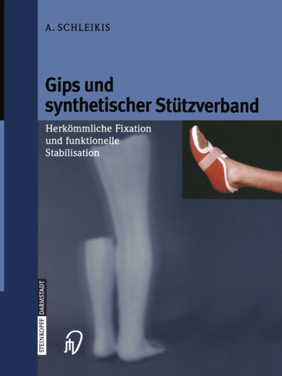 Gips und synthetischer Stützverband