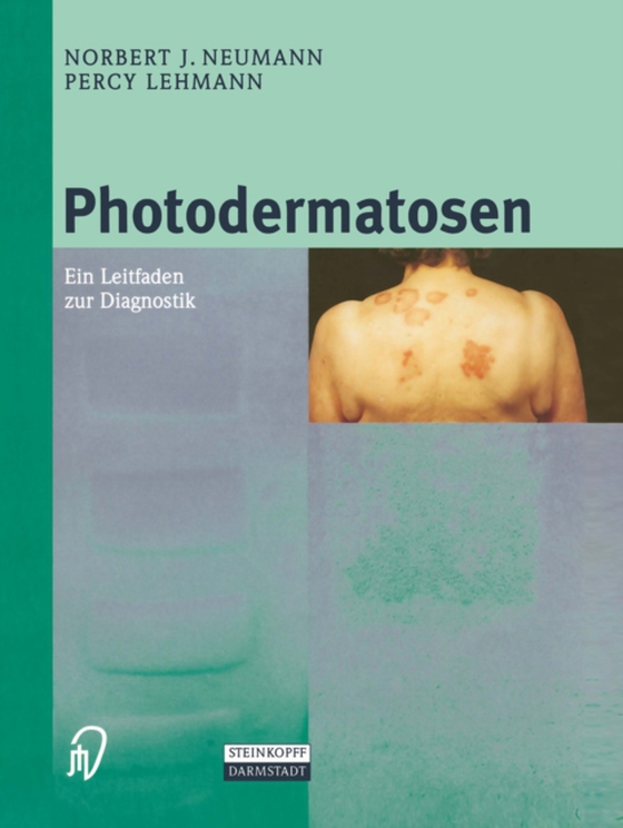 Photodermatosen (e-bog) af Lehmann, Percy