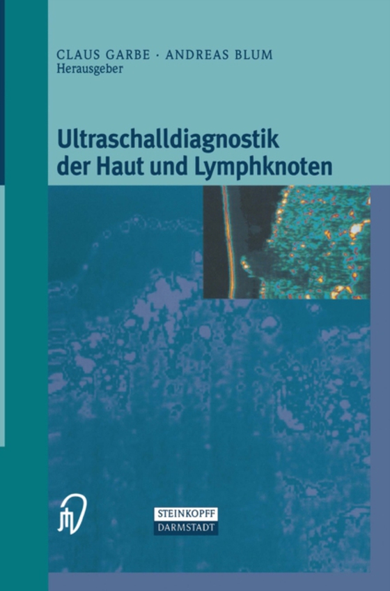 Ultraschalldiagnostik der Haut und Lymphknoten (e-bog) af -