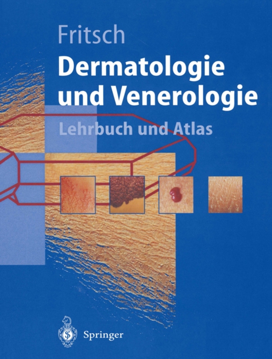 Dermatologie und Venerologie (e-bog) af Fritsch, Peter