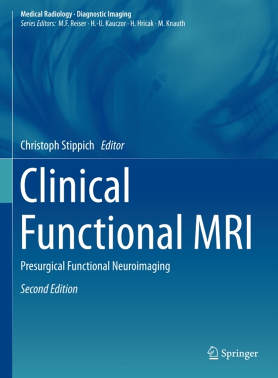 Clinical Functional MRI (e-bog) af -