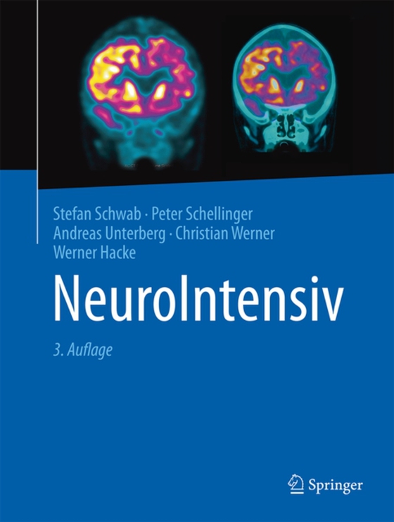 NeuroIntensiv (e-bog) af -