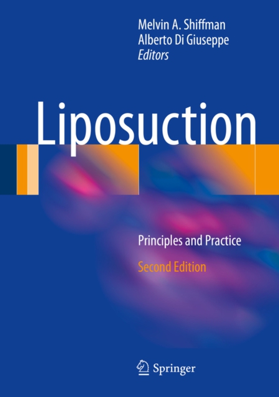 Liposuction (e-bog) af -