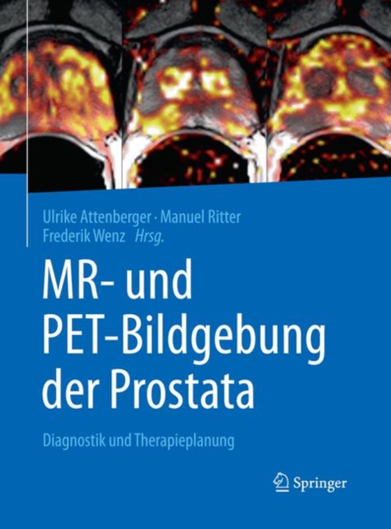 MR- und PET-Bildgebung der Prostata (e-bog) af -