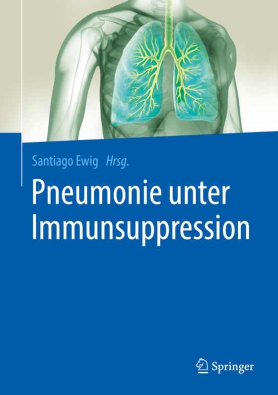 Pneumonie unter Immunsuppression (e-bog) af -