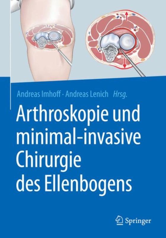 Arthroskopie und minimal-invasive Chirurgie des Ellenbogens (e-bog) af -