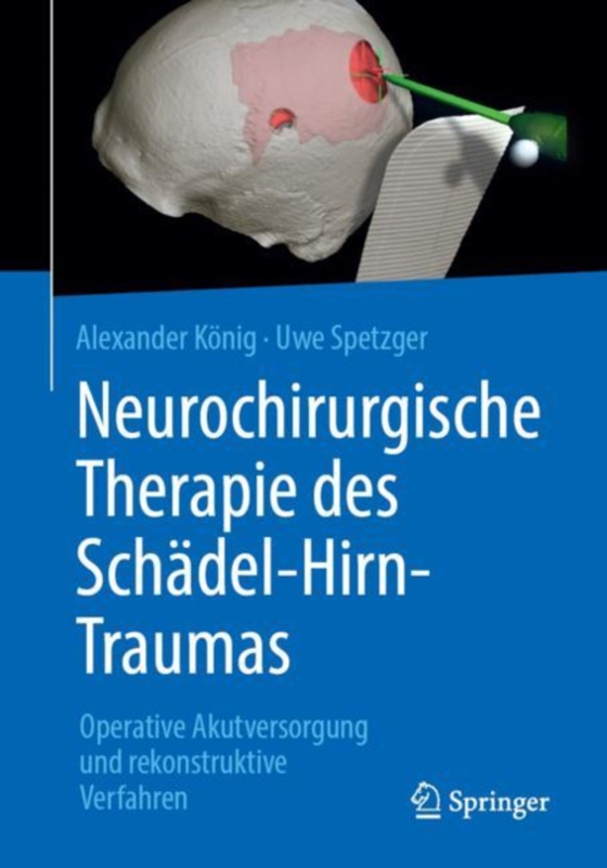 Neurochirurgische Therapie des Schädel-Hirn-Traumas (e-bog) af Spetzger, Uwe