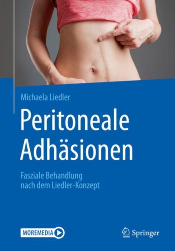 Peritoneale Adhäsionen (e-bog) af Liedler, Michaela