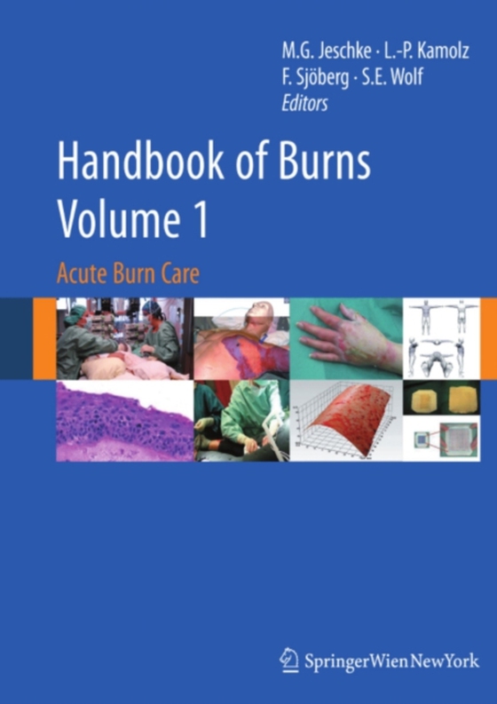 Handbook of Burns Volume 1 (e-bog) af -