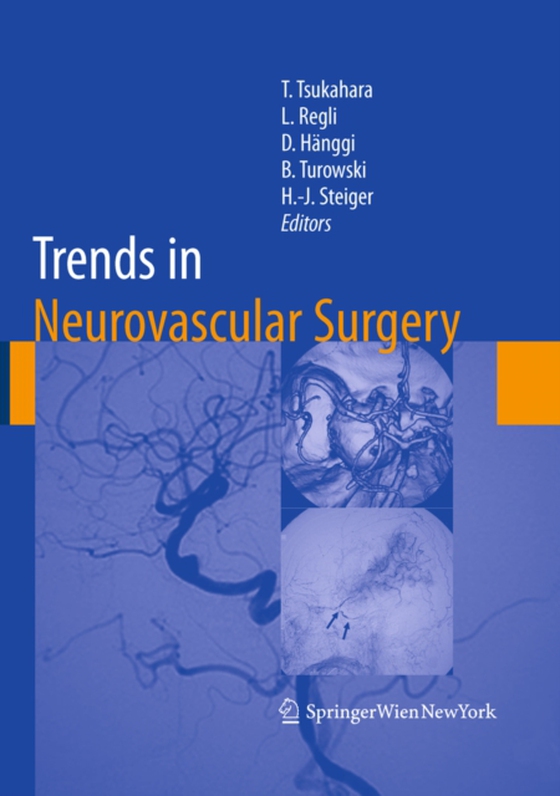 Trends in Neurovascular Surgery (e-bog) af -