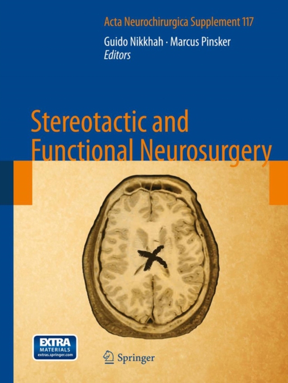 Stereotactic and Functional Neurosurgery (e-bog) af -