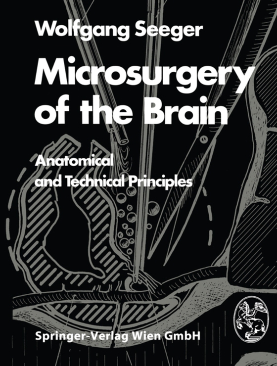 Microsurgery of the Brain (e-bog) af Seeger, W.