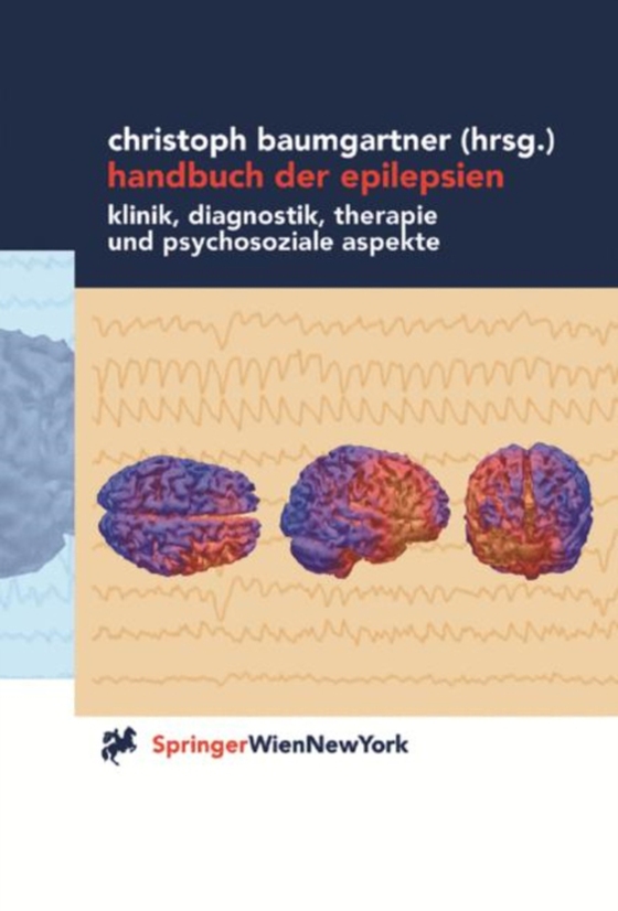 Handbuch der Epilepsien (e-bog) af -