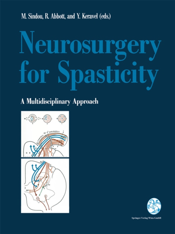 Neurosurgery for Spasticity (e-bog) af -