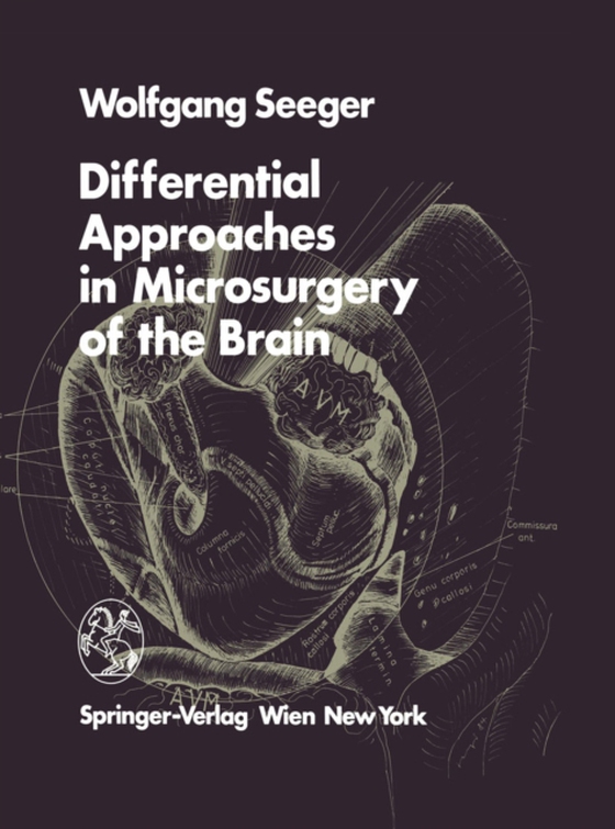 Differential Approaches in Microsurgery of the Brain (e-bog) af Seeger, W.