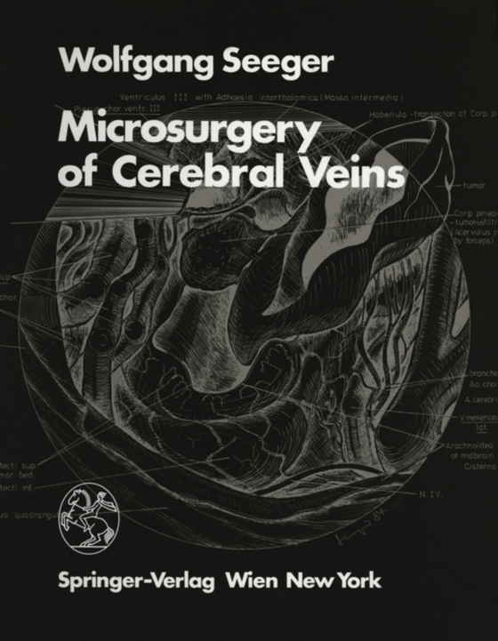 Microsurgery of Cerebral Veins (e-bog) af Seeger, W.