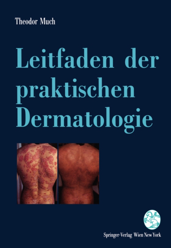 Leitfaden der praktischen Dermatologie (e-bog) af Much, Theodor