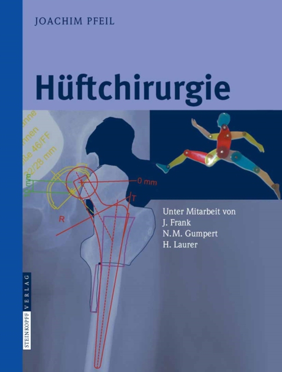 Hüftchirurgie