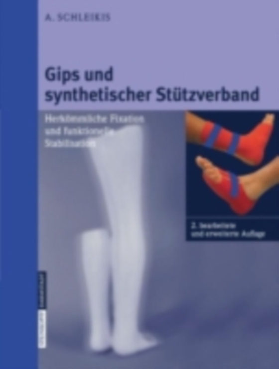 Gips und synthetischer Stützverband (e-bog) af Schleikis, A.