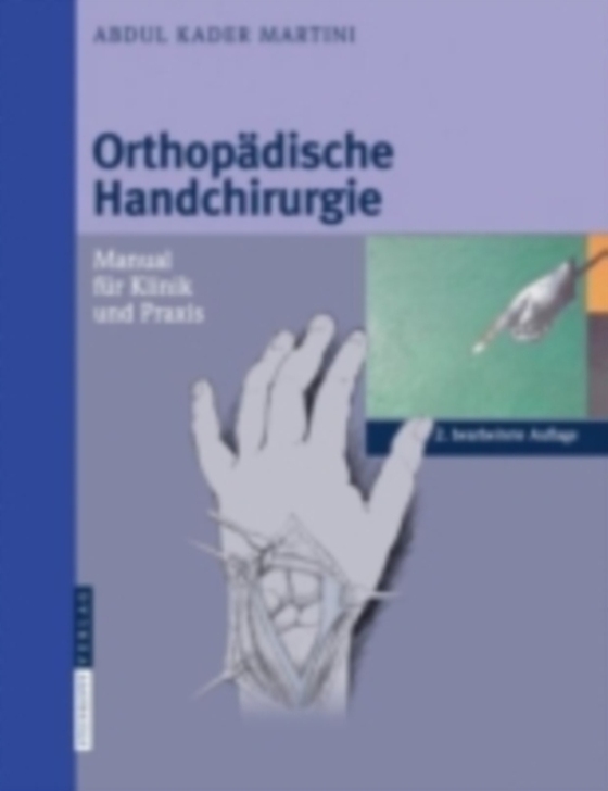 Orthopädische Handchirurgie (e-bog) af Martini, Abdul Kader