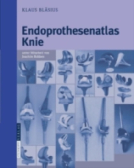 Endoprothesenatlas Knie (e-bog) af Blasius, Klaus