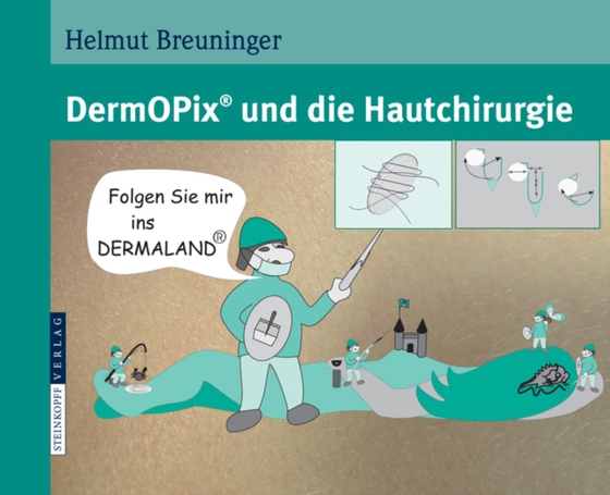 DermOPix® und die Hautchirurgie (e-bog) af Breuninger, Helmut