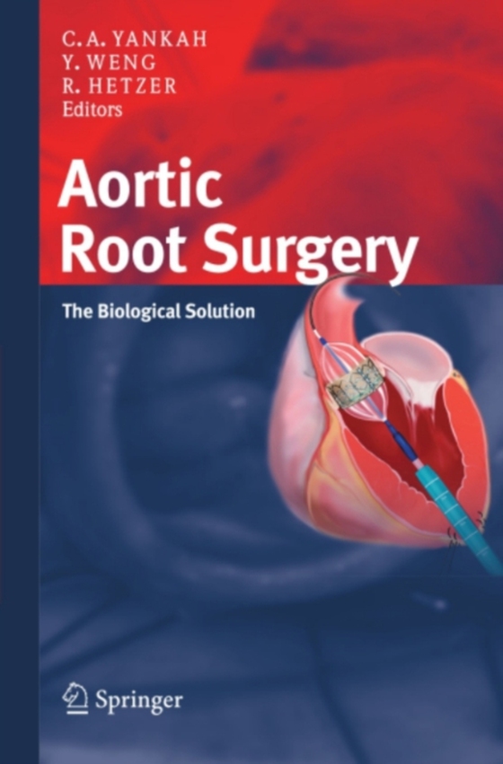 Aortic Root Surgery (e-bog) af -