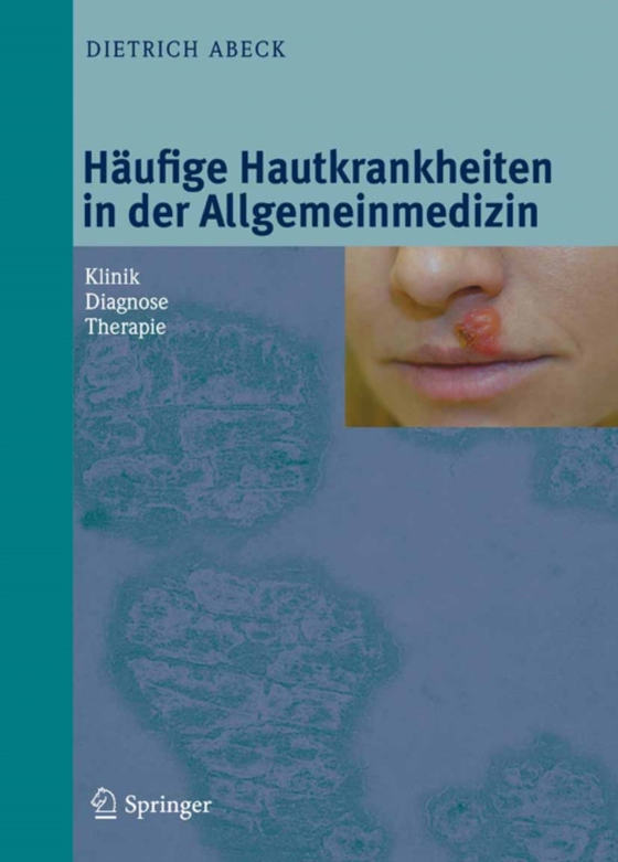 Häufige Hautkrankheiten in der Allgemeinmedizin (e-bog) af Abeck, Dietrich