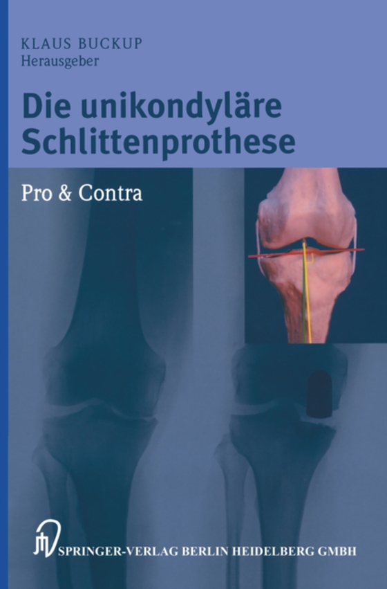 Die unikondyläre Schlittenprothese Pro & Contra