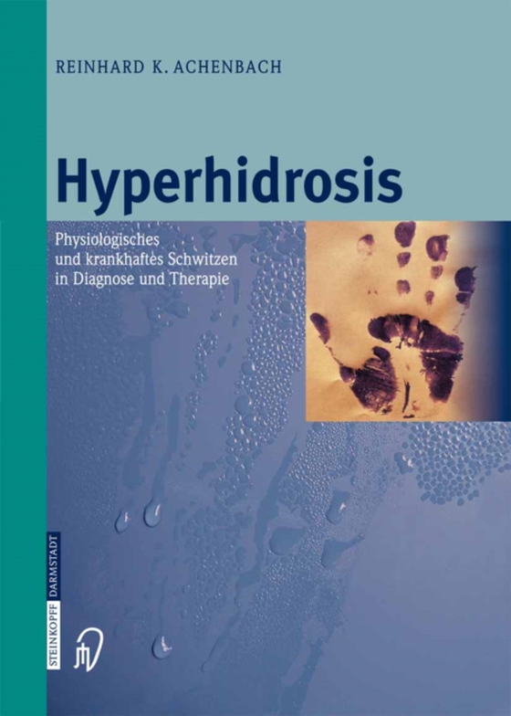 Hyperhidrosis