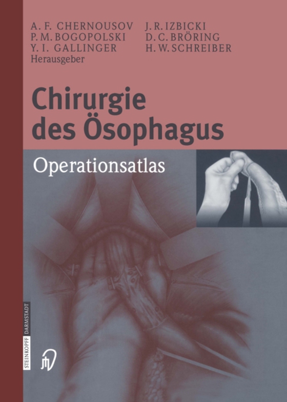 Chirurgie des Ösophagus (e-bog) af -