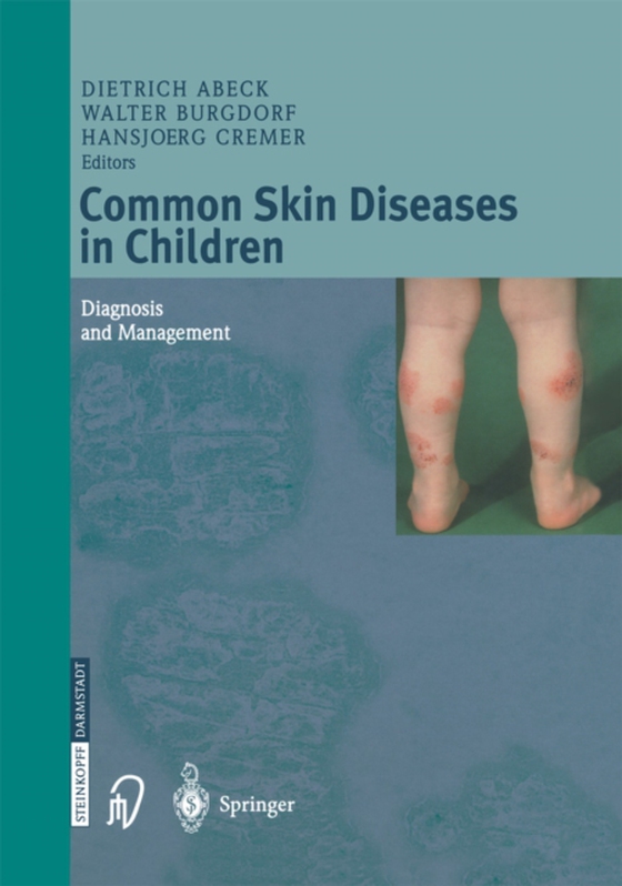 Common Skin Diseases in Children