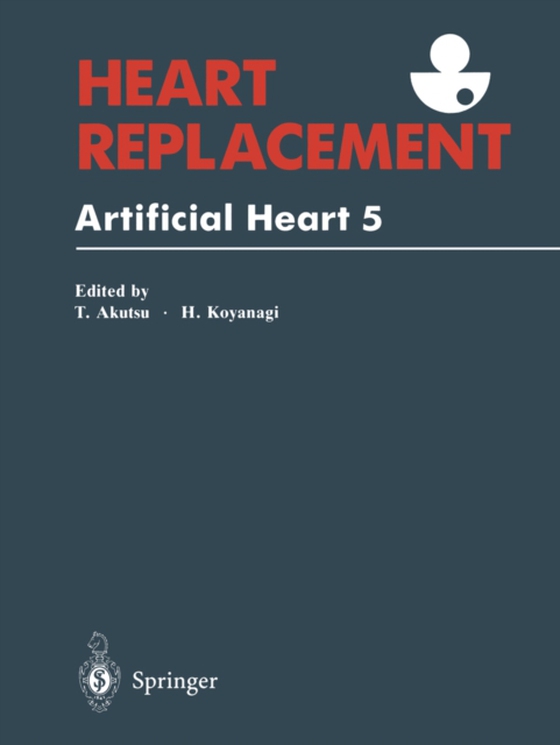 Heart Replacement (e-bog) af -