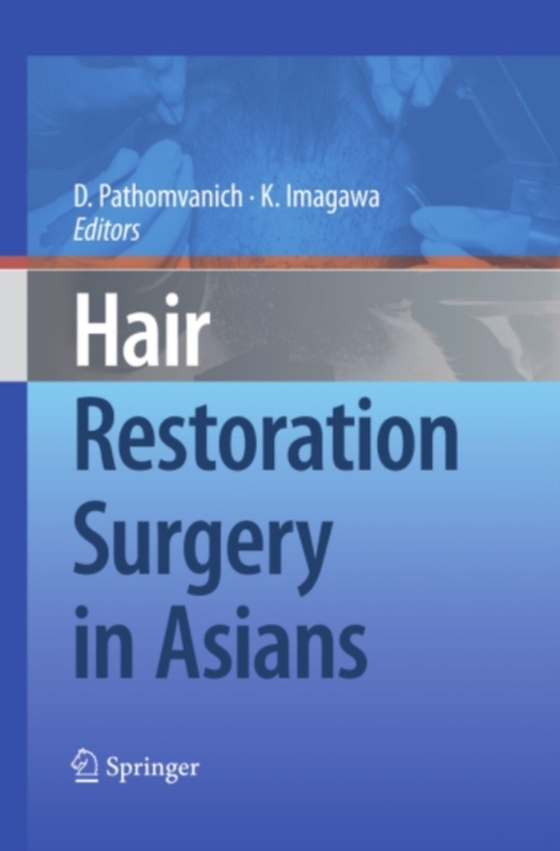 Hair Restoration Surgery in Asians (e-bog) af -