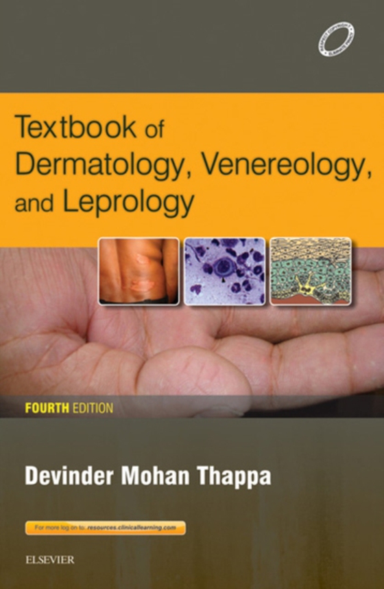 Textbook of Dermatology, Leprology & Venereology E-book (e-bog) af Thappa, Devinder Mohan