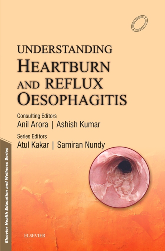 Understanding Heartburn and Reflux Oesophagitis - e-Book (e-bog) af Nundy, Samiran