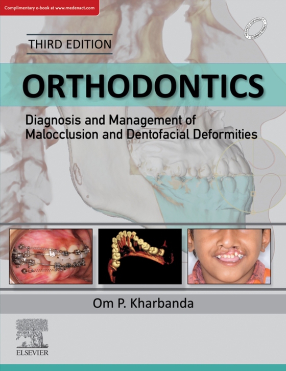 Orthodontics: Diagnosis and Management of Malocclusion and Dentofacial Deformities, E-Book (e-bog) af Kharbanda, Om Prakash