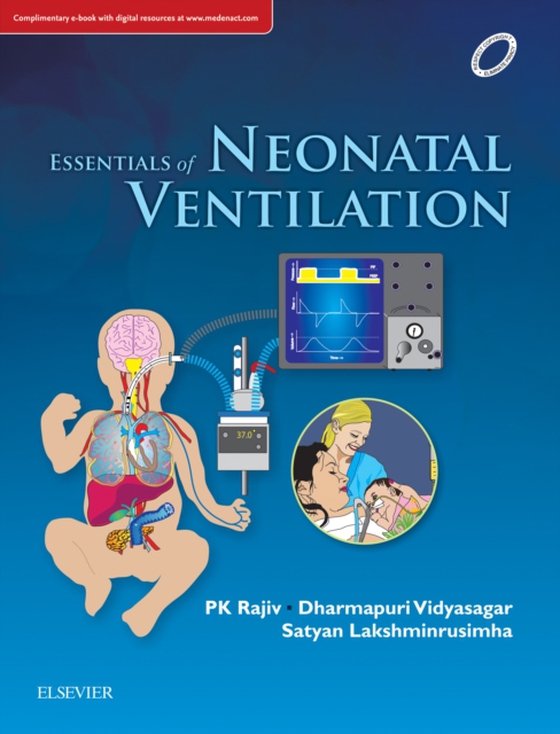 Essentials of Neonatal Ventilation, 1st edition, E-book (e-bog) af -