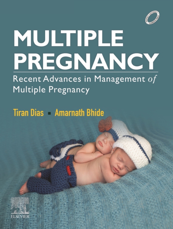 Multiple Pregnancy- E-book