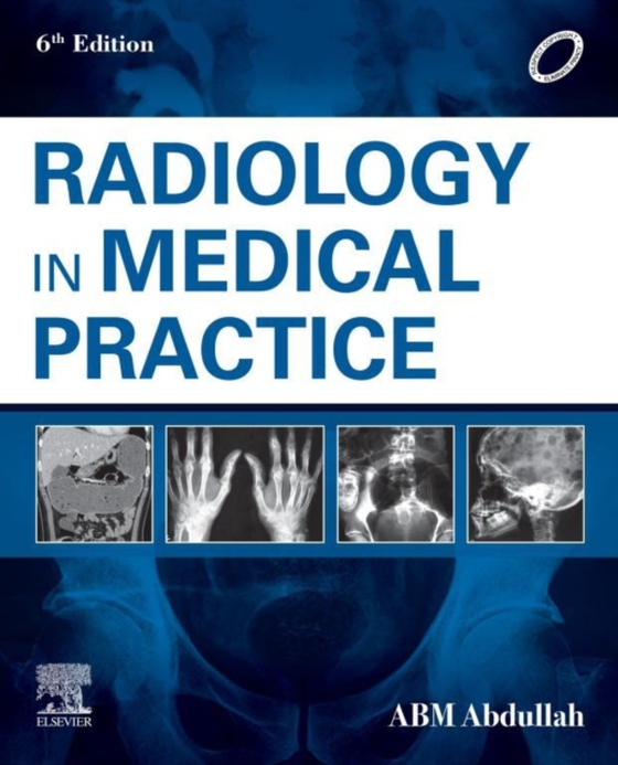 Radiology in Medical Practice - E-book (e-bog) af Abdullah, A B M