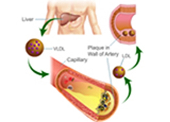 Estimation of Blood LDL Cholesterol and VLDL Cholesterol (e-bog) af Shah, Seema