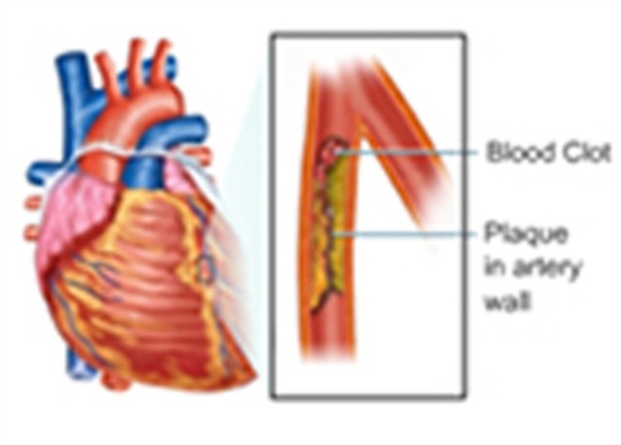 Estimation of Blood Triglycerides (e-bog) af Shah, Seema