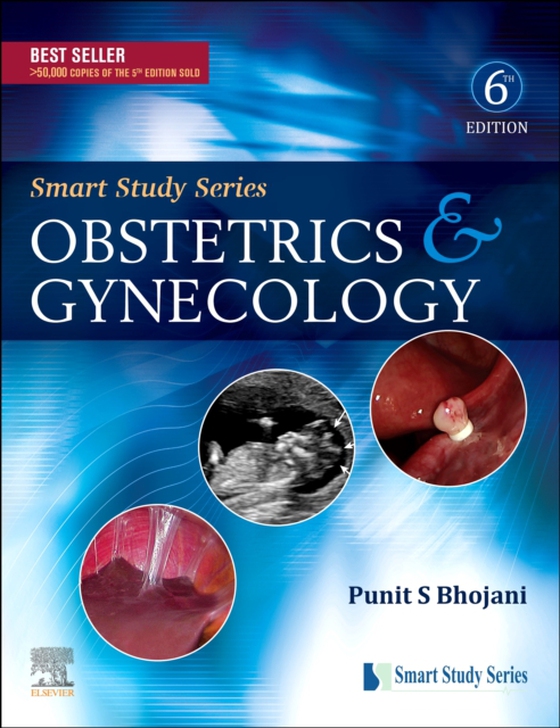 Smart Study Series:Obstetrics & Gynecology (e-bog) af BHOJANI, PUNIT S