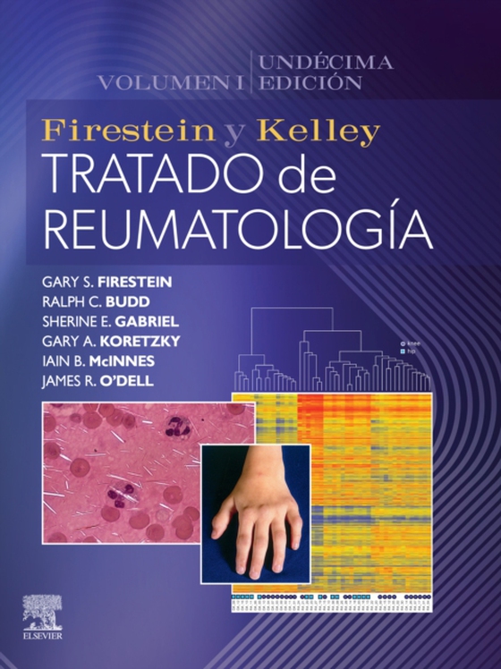 Firestein y Kelley. Tratado de reumatología (e-bog) af O'Dell, James R.