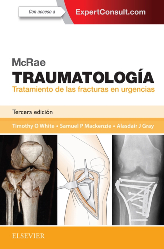 McRae. Traumatología. Tratamiento de las fracturas en urgencias (e-bog) af Gray, Alasdair J