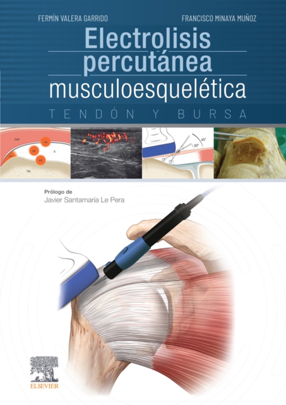 Electrolisis percutánea musculoesquelética (e-bog) af -