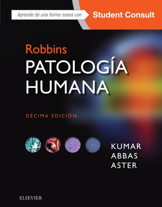 Robbins. Patología humana (e-bog) af Aster, Jon C.